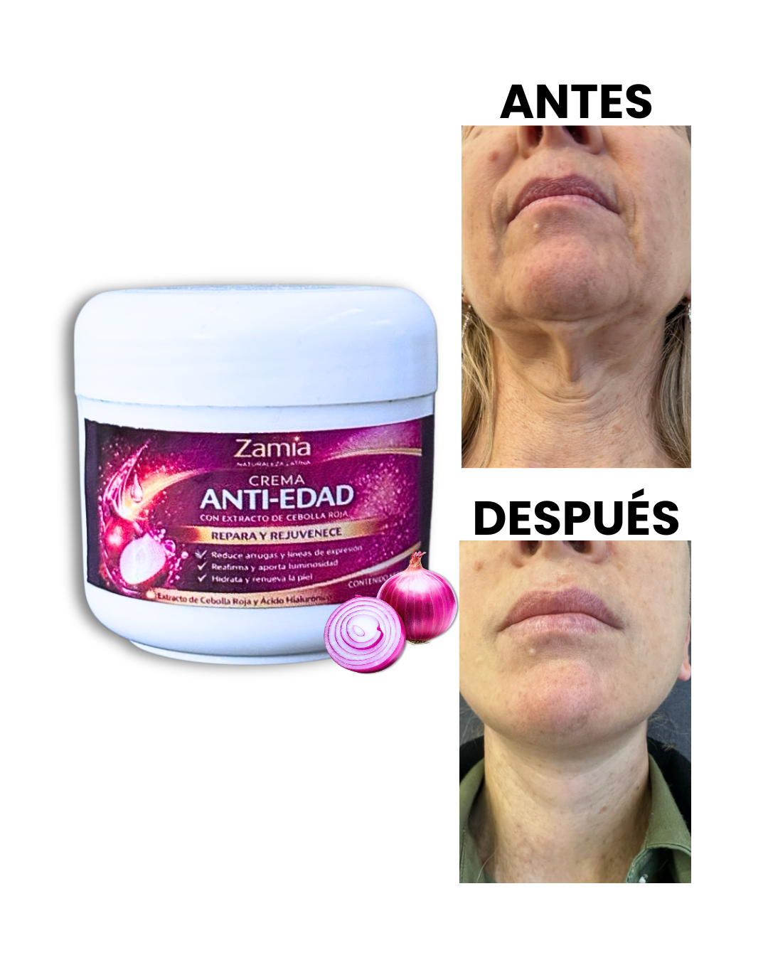 ANTI EDAD EXTRACTO DE CEBOLLA ORIGINAL